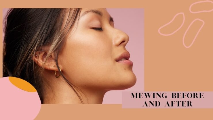 3 Effective Transformation: Mewing Before And After – Jawliner USA